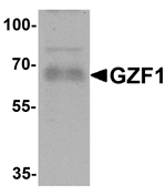 Western blot analysis of GZF1 in human heart tissue lysate with GZF1 antibody at 1 µg/mL.