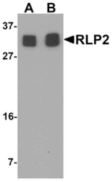 Western blot - RLP2 Antibody from Signalway Antibody (25475) - Antibodies.com
