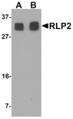Western blot - RLP2 Antibody from Signalway Antibody (25475) - Antibodies.com