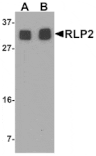 Western blot - RLP2 Antibody from Signalway Antibody (25475) - Antibodies.com