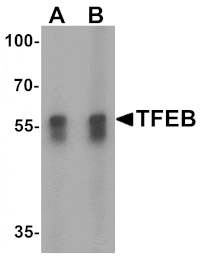 Western blot - TFEB Antibody from Signalway Antibody (25476) - Antibodies.com