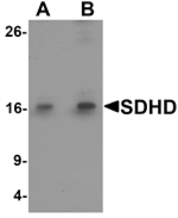Western blot - SDHD Antibody from Signalway Antibody (25490) - Antibodies.com