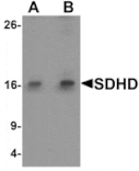 Western blot - SDHD Antibody from Signalway Antibody (25490) - Antibodies.com