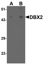 Western blot analysis of DBX2 in human kidney tissue lysate with DBX2 antibody at (A) 1 and (B) 2 µg/mL.