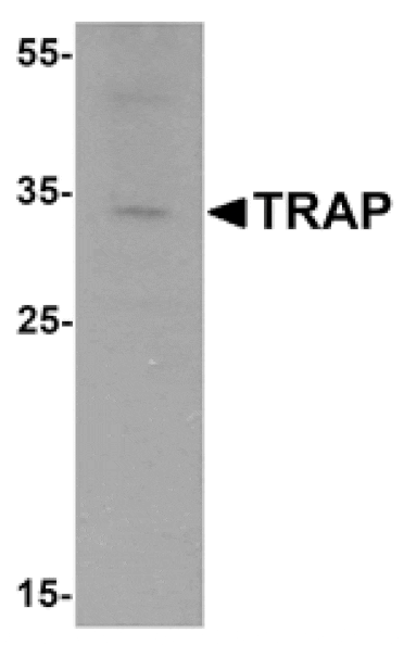 Western blot - TRAP Antibody from Signalway Antibody (25505) - Antibodies.com