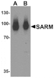 Western blot - SARM Antibody from Signalway Antibody (25506) - Antibodies.com