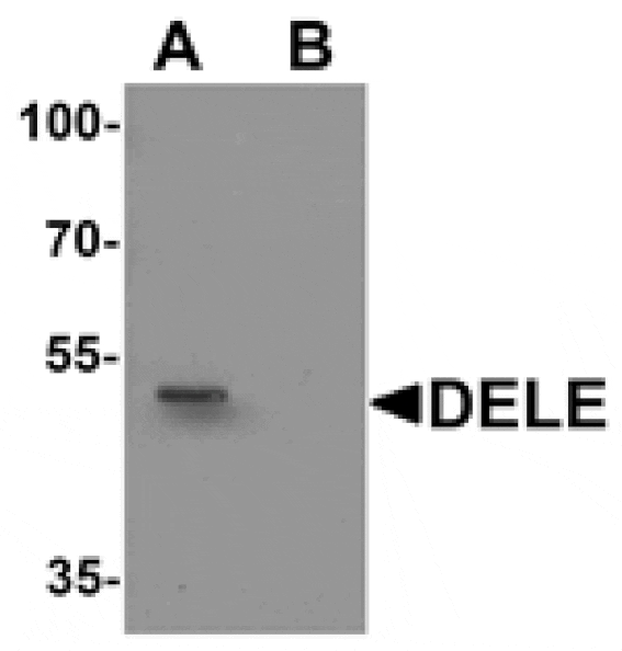 Western blot - DELE Antibody from Signalway Antibody (25507) - Antibodies.com