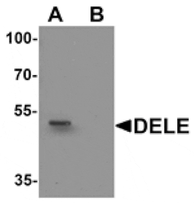 Western blot - DELE Antibody from Signalway Antibody (25507) - Antibodies.com