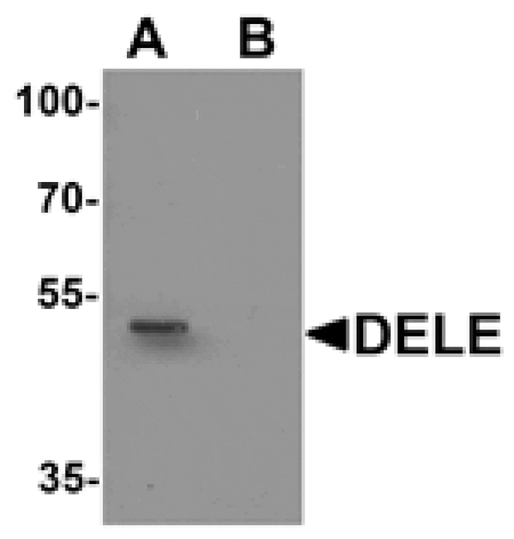 Western blot - DELE Antibody from Signalway Antibody (25507) - Antibodies.com