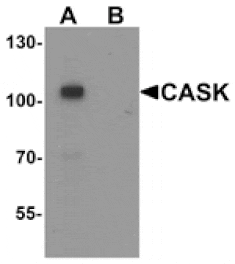 Western blot - CASK Antibody from Signalway Antibody (25508) - Antibodies.com