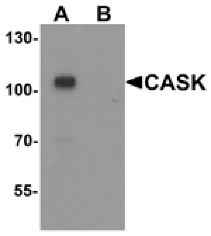 Western blot - CASK Antibody from Signalway Antibody (25508) - Antibodies.com