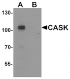 Western blot - CASK Antibody from Signalway Antibody (25508) - Antibodies.com