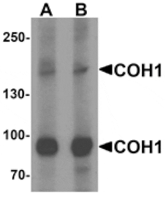 Western blot - COH1 Antibody from Signalway Antibody (25512) - Antibodies.com