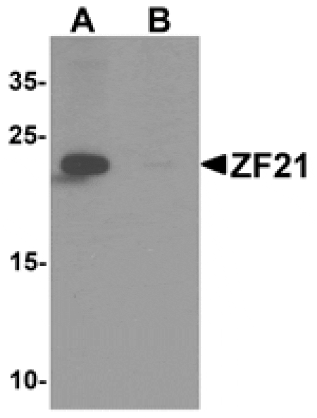 Western blot - ZF21 Antibody from Signalway Antibody (25514) - Antibodies.com