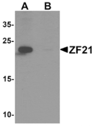 Western blot - ZF21 Antibody from Signalway Antibody (25514) - Antibodies.com