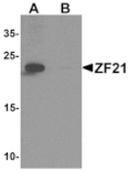 Western blot - ZF21 Antibody from Signalway Antibody (25514) - Antibodies.com