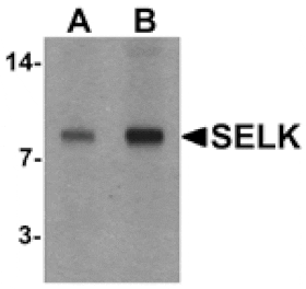 Western blot - SELK Antibody from Signalway Antibody (25519) - Antibodies.com