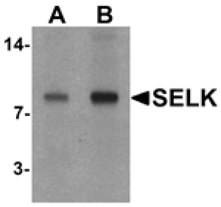 Western blot - SELK Antibody from Signalway Antibody (25519) - Antibodies.com