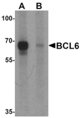 Western blot - BCL6 Antibody from Signalway Antibody (25523) - Antibodies.com