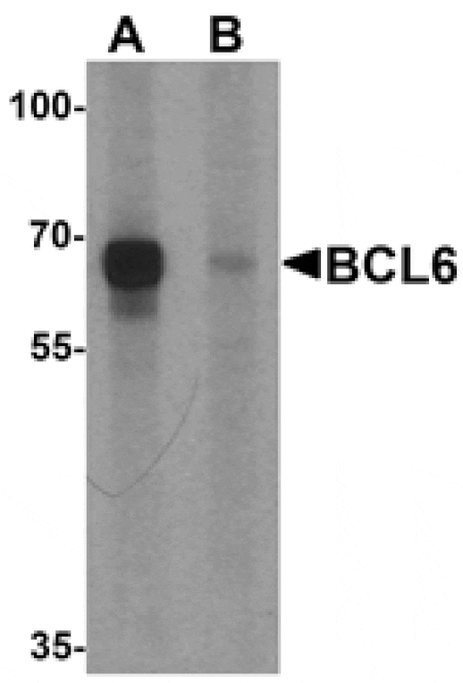 Western blot - BCL6 Antibody from Signalway Antibody (25523) - Antibodies.com