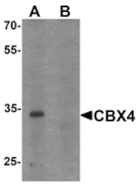 Western blot - CBX4 Antibody from Signalway Antibody (25530) - Antibodies.com