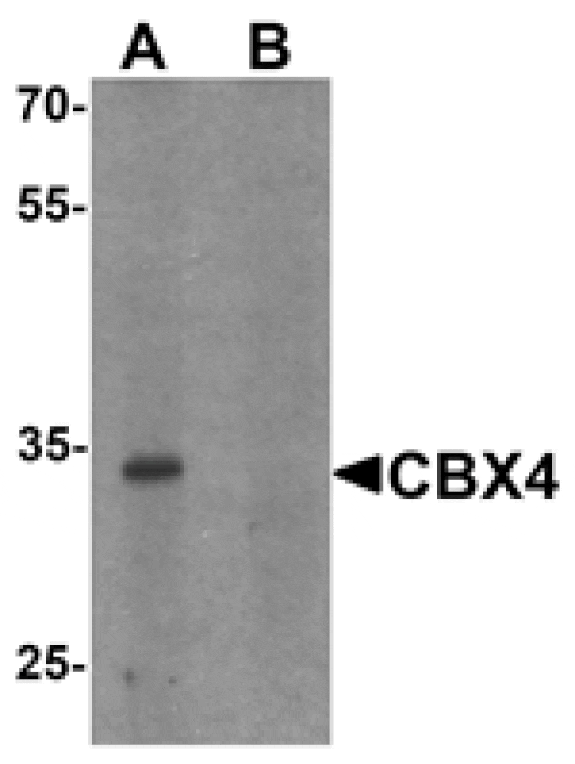 Western blot - CBX4 Antibody from Signalway Antibody (25530) - Antibodies.com