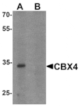 Western blot - CBX4 Antibody from Signalway Antibody (25530) - Antibodies.com