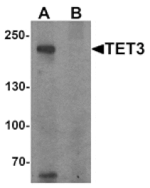 Western blot - TET3 Antibody from Signalway Antibody (25532) - Antibodies.com