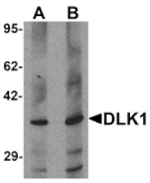 Western blot - DLK1 Antibody from Signalway Antibody (25534) - Antibodies.com