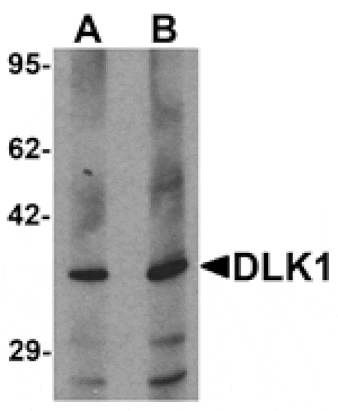 Western blot - DLK1 Antibody from Signalway Antibody (25534) - Antibodies.com