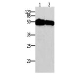 TP53 Antibody from Signalway Antibody (31013) - Antibodies.com