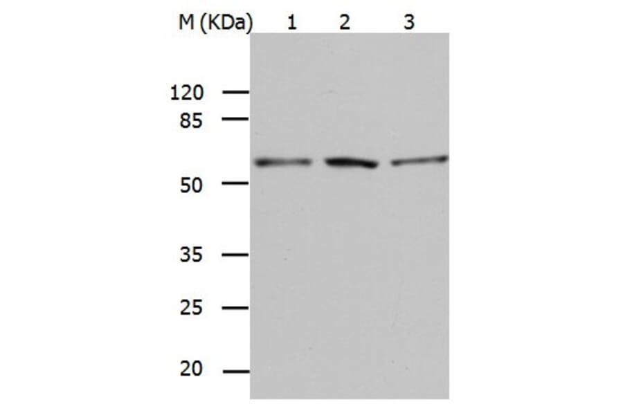 BAG5 Antibody from Signalway Antibody (31019) - Antibodies.com