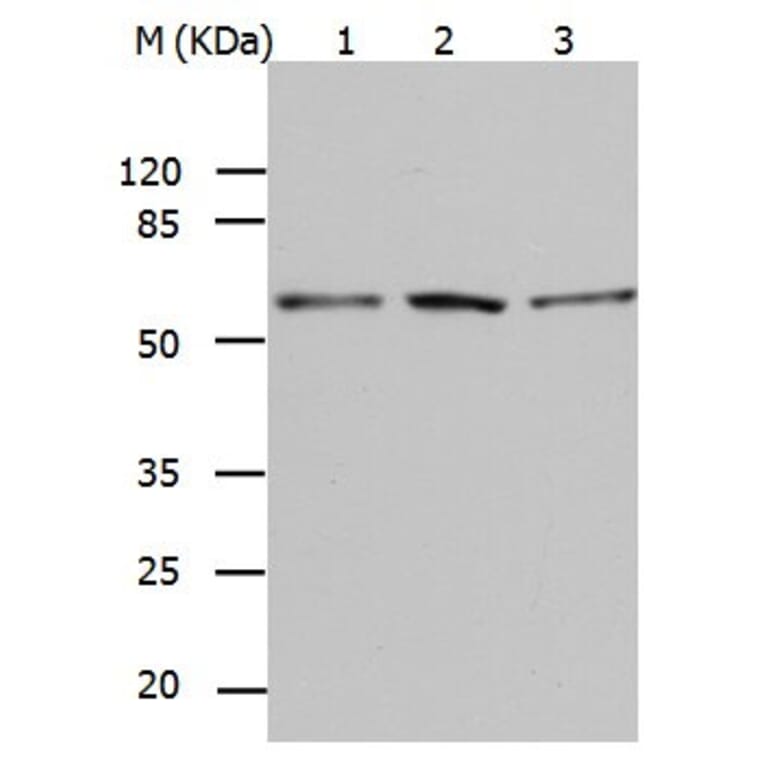 BAG5 Antibody from Signalway Antibody (31019) - Antibodies.com