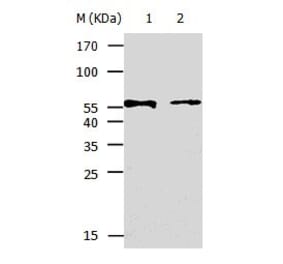 KRT5 Antibody from Signalway Antibody (31032) - Antibodies.com