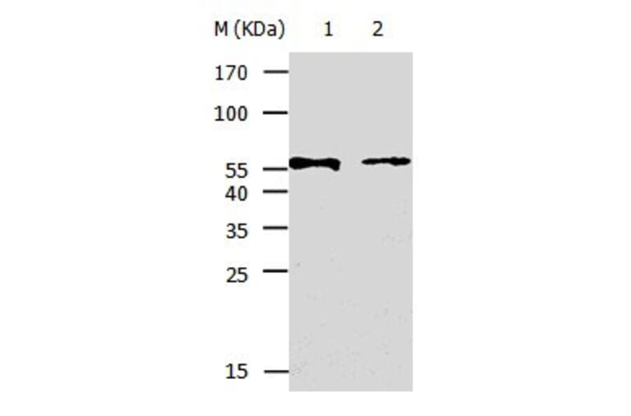 KRT5 Antibody from Signalway Antibody (31032) - Antibodies.com