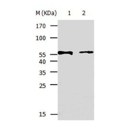 KRT5 Antibody from Signalway Antibody (31032) - Antibodies.com