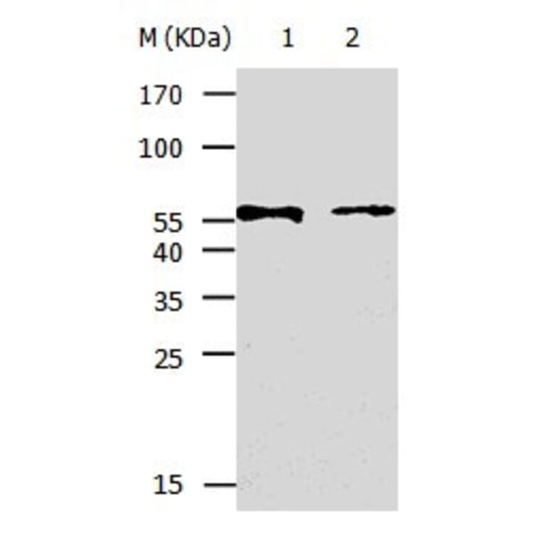 KRT5 Antibody from Signalway Antibody (31032) - Antibodies.com