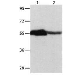 CBX2 Antibody from Signalway Antibody (31050) - Antibodies.com