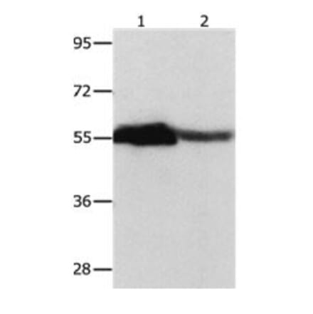 CBX2 Antibody from Signalway Antibody (31050) - Antibodies.com