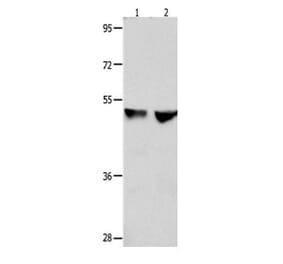 CDK9 Antibody from Signalway Antibody (31055) - Antibodies.com