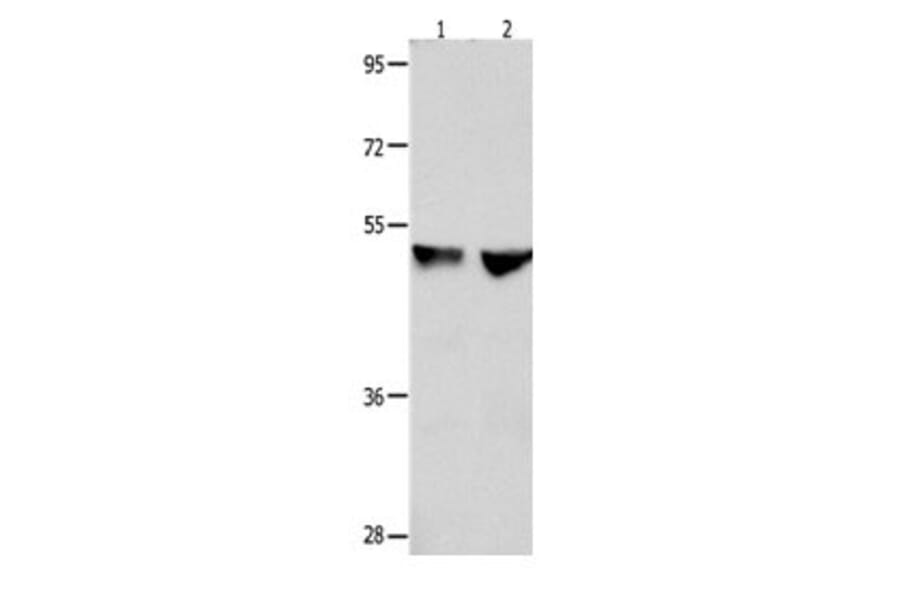 CDK9 Antibody from Signalway Antibody (31055) - Antibodies.com