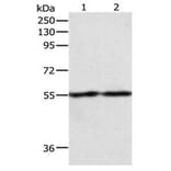 EGR1 Antibody from Signalway Antibody (31068) - Antibodies.com