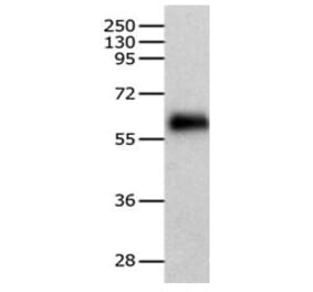 HSF2 Antibody from Signalway Antibody (31084) - Antibodies.com