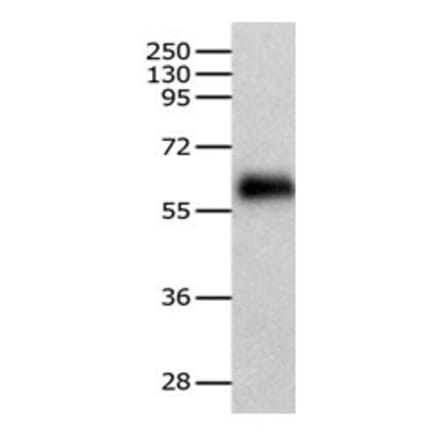 HSF2 Antibody from Signalway Antibody (31084) - Antibodies.com