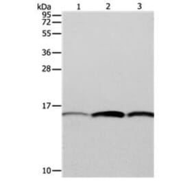 PFN1 Antibody from Signalway Antibody (31115) - Antibodies.com