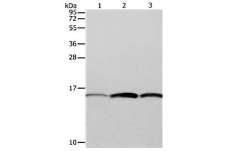 PFN1 Antibody from Signalway Antibody (31115) - Antibodies.com