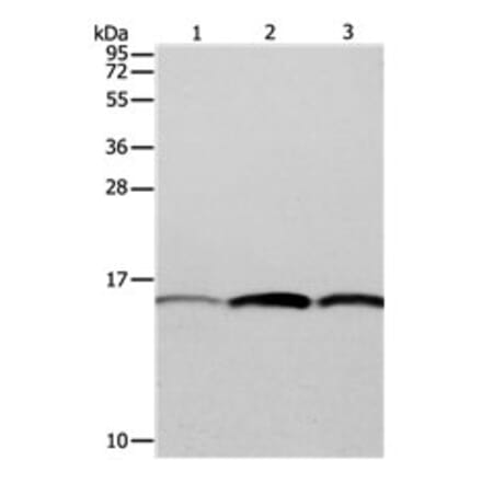 PFN1 Antibody from Signalway Antibody (31115) - Antibodies.com