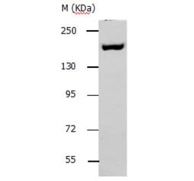 ACE1 Antibody from Signalway Antibody (31140) - Antibodies.com