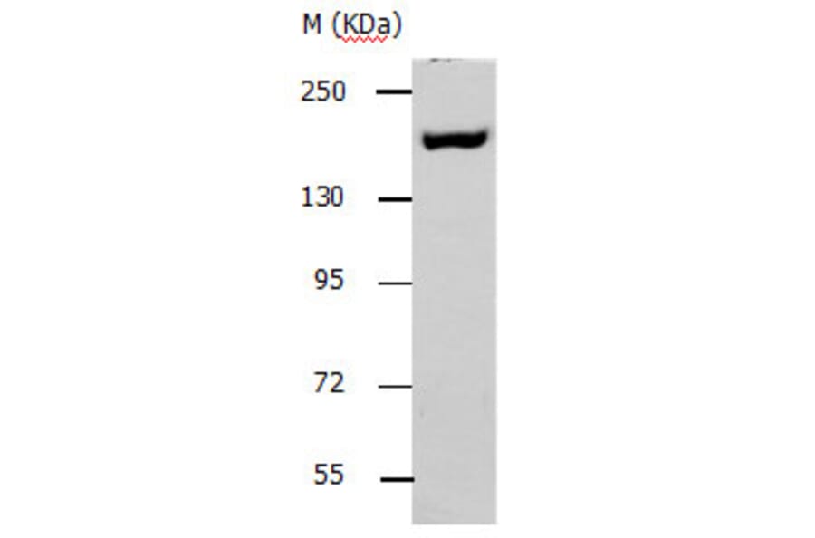 ACE1 Antibody from Signalway Antibody (31140) - Antibodies.com