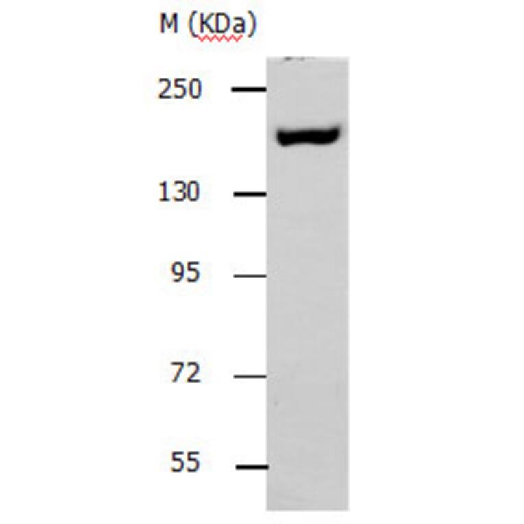 ACE1 Antibody from Signalway Antibody (31140) - Antibodies.com